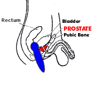 Figure Two