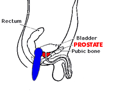 Figure Two